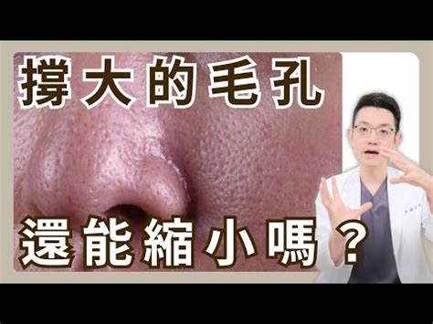 臉頰長白毛|臉長白毛：避免誤診與誤治